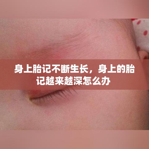 身上胎记不断生长，身上的胎记越来越深怎么办 