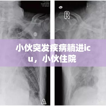 小伙突发疾病躺进icu，小伙住院 