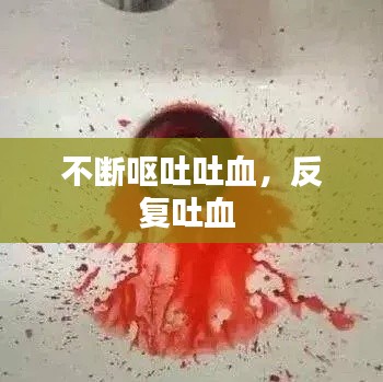 不断呕吐吐血，反复吐血 